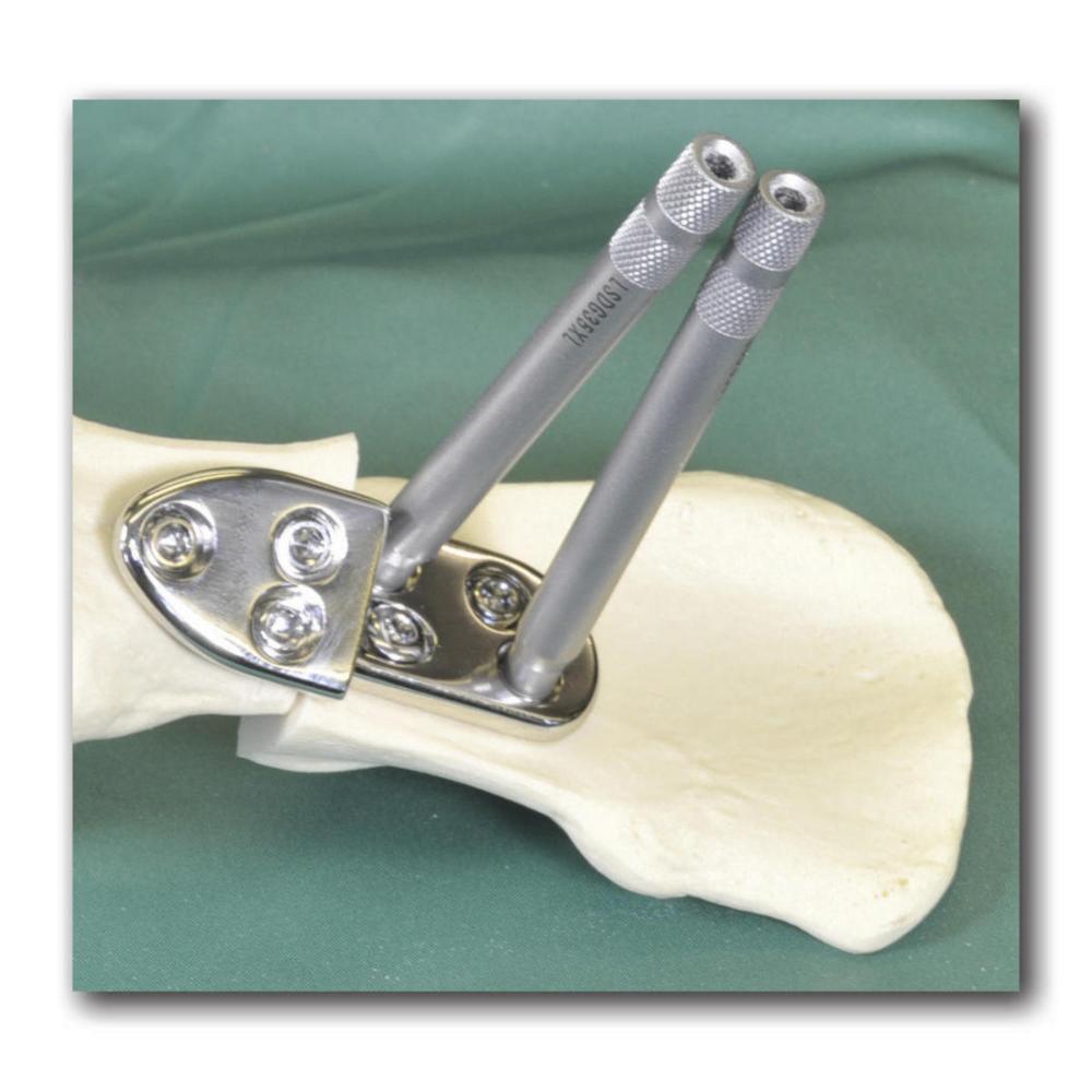 Bohrlehre für 2,7 mm Lockingschrauben extra lang (LSDG2724XL)