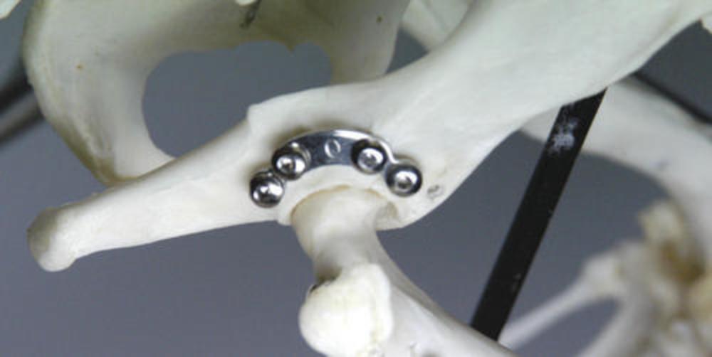 2,0 Acetabulum-Platte, Größe L, 4 Loch (AP200401L)