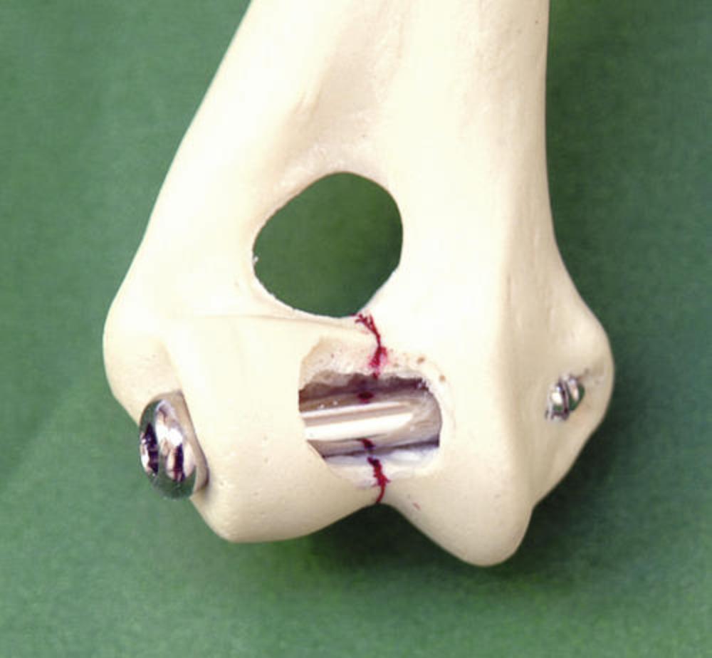 Schaftschraube 4,5, 32mm, 13mm Gewinde SHSC4532