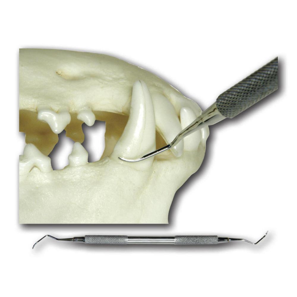 Zahnkürette, subgingival, 170mm lang (012130)