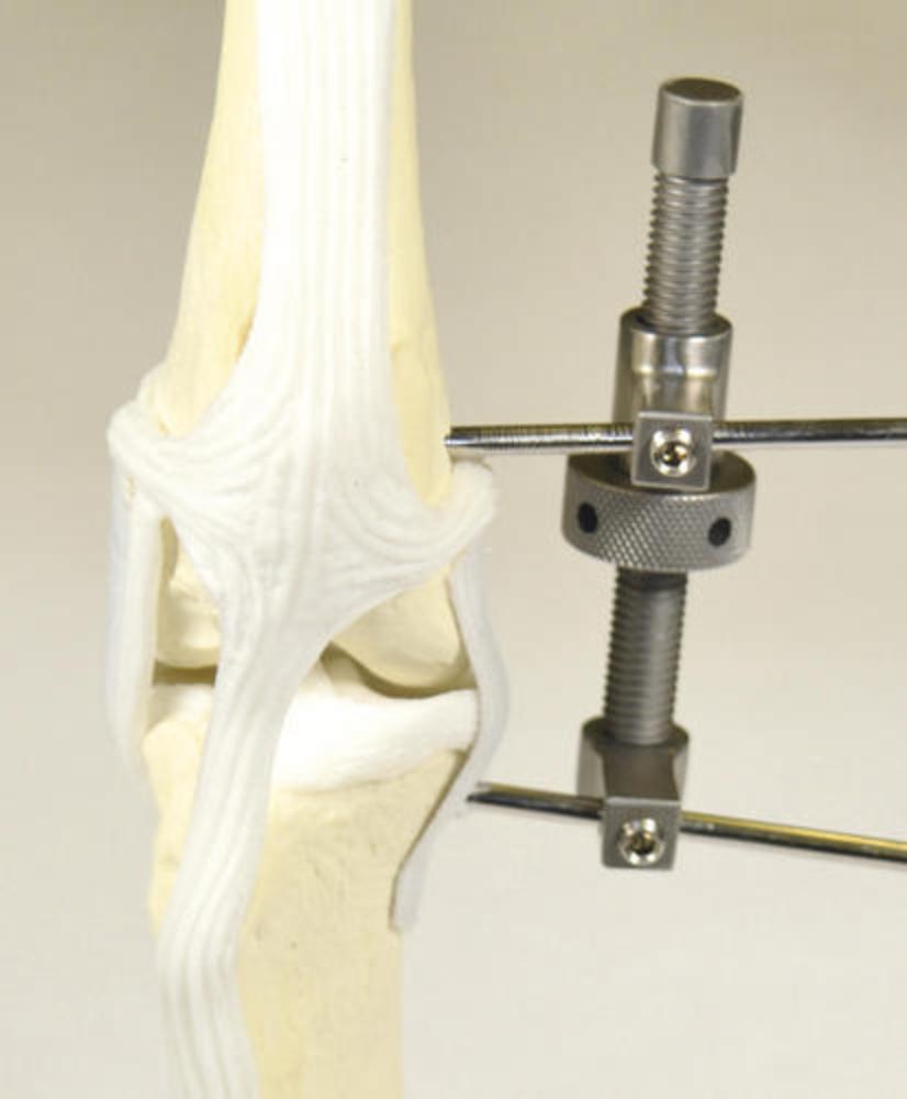 Gelenkspreizer Extraartikulär, 3,2mm Draht, 80mm lang (AR-17-01/TPLO)